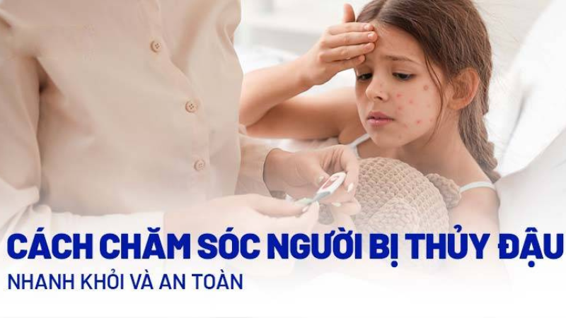 bệnh thuỷ đậu