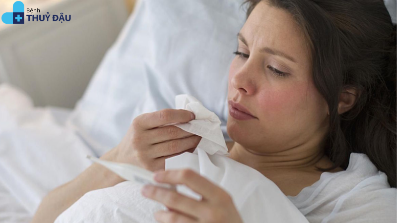 bệnh thủy đậu ở người lớn kiêng gì